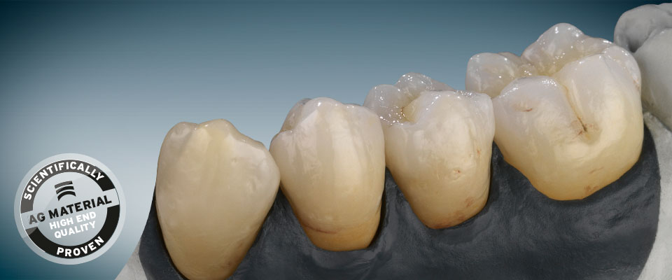 Sứ Ceramill Sintron